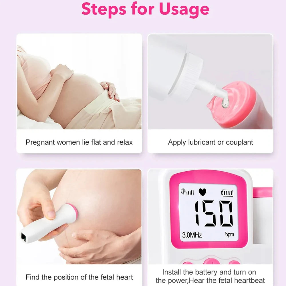 Doppler Fetal Portátil com Tela LCD – Monitor de Batimentos Cardíacos do Bebê 3.0MHz para Uso Doméstico em Gestantes